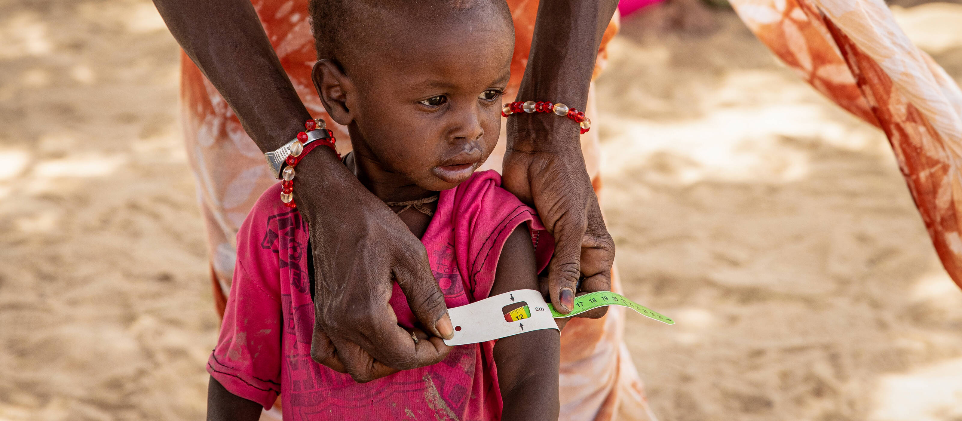 Malnourished and undernourished children abound in the region due to food and water shortages.